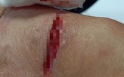 Người dân lao vào đập chết con chó cắn bị thương nhiều người giữa chợ Người dân lao vào đập chết con chó cắn bị thương nhiều người giữa chợ