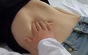 Nặn mụn ở ngực, nữ sinh 20 tuổi khiến bác sĩ giật mình khi nhìn thấy "vòng một" Nặn mụn ở ngực, nữ sinh 20 tuổi khiến bác sĩ giật mình khi nhìn thấy "vòng một"