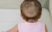 Bác sĩ dinh dưỡng giải đáp 5 "truyền thuyết" về bổ sung canxi và vitamin D cho trẻ Bác sĩ dinh dưỡng giải đáp 5 "truyền thuyết" về bổ sung canxi và vitamin D cho trẻ