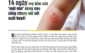 14 ngày mẹ bỉm sữa "mệt nhừ" cùng con sống chung với sốt xuất huyết 14 ngày mẹ bỉm sữa "mệt nhừ" cùng con sống chung với sốt xuất huyết