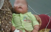 Uống kháng sinh mẹ tự mua, bé 8 tháng tuổi suýt chết Uống kháng sinh mẹ tự mua, bé 8 tháng tuổi suýt chết