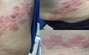 Mưa nắng thất thường, bệnh có thể gây dị tật thai nhi gia tăng, BS chỉ cách phòng đơn giản Mưa nắng thất thường, bệnh có thể gây dị tật thai nhi gia tăng, BS chỉ cách phòng đơn giản