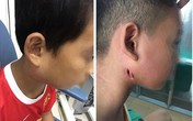 Phòng bệnh whitmore "ăn thịt người": Người dân cần làm tốt những việc này Phòng bệnh whitmore "ăn thịt người": Người dân cần làm tốt những việc này