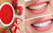 Mẹo loại bỏ các mảng bám trên răng giúp hàm răng trở nên trắng sáng của quả dâu tây Mẹo loại bỏ các mảng bám trên răng giúp hàm răng trở nên trắng sáng của quả dâu tây
