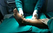 'Cậu nhỏ' và các phần cơ thể bị đứt rời: Phải bảo quản cách này thì bác sĩ mới nhất định cứu được 'Cậu nhỏ' và các phần cơ thể bị đứt rời: Phải bảo quản cách này thì bác sĩ mới nhất định cứu được