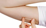 Chị em định dùng que cấy tránh thai nên biết những điều này Chị em định dùng que cấy tránh thai nên biết những điều này