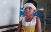 Sức khỏe của cô bé 8 tuổi bị bỏng cồn cả người thoát chết kỳ diệu hiện ra sao? Sức khỏe của cô bé 8 tuổi bị bỏng cồn cả người thoát chết kỳ diệu hiện ra sao?
