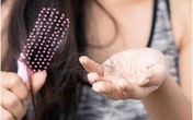 Những mẹo hiệu quả giúp tóc không còn rụng ngày giao mùa Những mẹo hiệu quả giúp tóc không còn rụng ngày giao mùa
