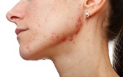 10 thay đổi trên cơ thể tưởng nhẹ nhưng báo động bệnh nguy hiểm, 3 điều cảnh báo ung thư 10 thay đổi trên cơ thể tưởng nhẹ nhưng báo động bệnh nguy hiểm, 3 điều cảnh báo ung thư