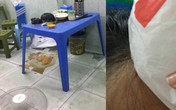 Đi ăn mỳ gà bị quạt rơi trúng đầu, cô gái run người sau câu nói của chủ quán Đi ăn mỳ gà bị quạt rơi trúng đầu, cô gái run người sau câu nói của chủ quán