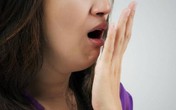 Cách phòng chứng hôi miệng Cách phòng chứng hôi miệng