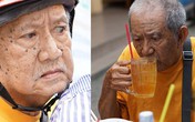 Vừa ra viện, Mạc Can đi nhận trợ cấp 2,6 triệu, ngồi trà đá với bạn bè Vừa ra viện, Mạc Can đi nhận trợ cấp 2,6 triệu, ngồi trà đá với bạn bè