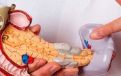 Cảnh báo bệnh ung thư ác tính nhất đường tiêu hoá, chỉ 4% người mắc sống sót được 5 năm Cảnh báo bệnh ung thư ác tính nhất đường tiêu hoá, chỉ 4% người mắc sống sót được 5 năm