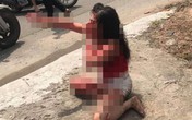 Phẫn nộ: Cô gái bị người tình cũ rạch mặt tàn ác Phẫn nộ: Cô gái bị người tình cũ rạch mặt tàn ác