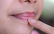 4 dấu hiệu trên khuôn mặt cảnh báo gan đang kêu cứu 4 dấu hiệu trên khuôn mặt cảnh báo gan đang kêu cứu