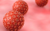 Sốc vì con học mẫu giáo đã nhiễm virus có thể gây ung thư và thường lây qua đường tình dục Sốc vì con học mẫu giáo đã nhiễm virus có thể gây ung thư và thường lây qua đường tình dục