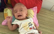 Căn bệnh chú lính chì Phạm Đức Lộc mắc suốt 3 năm qua có thể điều trị khỏi Căn bệnh chú lính chì Phạm Đức Lộc mắc suốt 3 năm qua có thể điều trị khỏi
