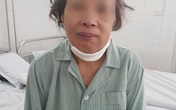 Tưởng chỉ bị viêm họng, sâu răng thông thường, người phụ nữ đi khám mới biết mình bị ung thư lợi hàm hiếm gặp Tưởng chỉ bị viêm họng, sâu răng thông thường, người phụ nữ đi khám mới biết mình bị ung thư lợi hàm hiếm gặp