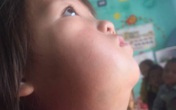 Xót thương bé gái vùng cao mồ côi mẹ, gương mặt méo lệch, nhà nghèo không có tiền chữa trị Xót thương bé gái vùng cao mồ côi mẹ, gương mặt méo lệch, nhà nghèo không có tiền chữa trị