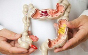 Hàng triệu người Việt vệ sinh sai cách làm tăng nguy cơ mắc bệnh tật Hàng triệu người Việt vệ sinh sai cách làm tăng nguy cơ mắc bệnh tật