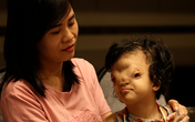 Mẹ của cô bé có khuôn mặt biến dạng ở Quảng Bình gửi con để đi giúp người dân chống lũ Mẹ của cô bé có khuôn mặt biến dạng ở Quảng Bình gửi con để đi giúp người dân chống lũ