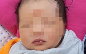 Cứu thai nhi suýt chết trong bụng mẹ Cứu thai nhi suýt chết trong bụng mẹ
