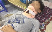 Học sinh lớp 4 bị “đàn anh” đánh đến nhập viện Học sinh lớp 4 bị “đàn anh” đánh đến nhập viện