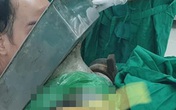 Bệnh nhân bị cối xay thịt nghiền nát cánh tay Bệnh nhân bị cối xay thịt nghiền nát cánh tay