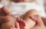 Cắt khối u khổng lồ ở ngực cho bé 3 ngày tuổi Cắt khối u khổng lồ ở ngực cho bé 3 ngày tuổi