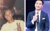 Đăng ảnh 16 năm trước bị người hâm mộ nghi ngờ phẫu thuật thẩm mỹ, MC Thành Trung nhanh chóng giải thích và khẳng định mình chưa từng động đến dao kéo Đăng ảnh 16 năm trước bị người hâm mộ nghi ngờ phẫu thuật thẩm mỹ, MC Thành Trung nhanh chóng giải thích và khẳng định mình chưa từng động đến dao kéo