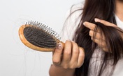 Bí quyết giữ mái tóc dày và bồng bềnh với thời gian bất chấp tuổi tác! Bí quyết giữ mái tóc dày và bồng bềnh với thời gian bất chấp tuổi tác!