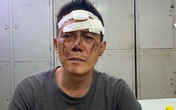 Gã đàn ông dùng kim tiêm uy hiếp cô gái trẻ ở quận 1 Gã đàn ông dùng kim tiêm uy hiếp cô gái trẻ ở quận 1