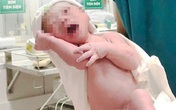 Bé trai chào đời với dây rốn thắt nút Bé trai chào đời với dây rốn thắt nút