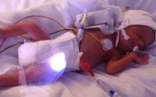 Bé gái mắc bệnh hiểm nghèo khó sống, bác sĩ bất lực trả về gia đình nhưng hành động chơi đùa vô tư của chị gái đã cứu em thoát khỏi "Tử thần" Bé gái mắc bệnh hiểm nghèo khó sống, bác sĩ bất lực trả về gia đình nhưng hành động chơi đùa vô tư của chị gái đã cứu em thoát khỏi "Tử thần"