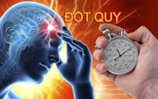 Những người có nguy cơ đột quỵ cao, nếu bạn trong nhóm này cần hết sức cảnh giác Những người có nguy cơ đột quỵ cao, nếu bạn trong nhóm này cần hết sức cảnh giác
