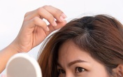 3 cách trị tóc bạc, rụng tóc dễ mua, dễ làm lại hiệu quả cho người trẻ tuổi 3 cách trị tóc bạc, rụng tóc dễ mua, dễ làm lại hiệu quả cho người trẻ tuổi