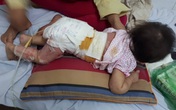 Trẻ nghỉ học ở nhà, cẩn trọng tai nạn bỏng Trẻ nghỉ học ở nhà, cẩn trọng tai nạn bỏng