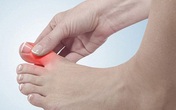 Kỳ diệu vuốt ngón chân cái giúp chữa nhiều bệnh hay gặp Kỳ diệu vuốt ngón chân cái giúp chữa nhiều bệnh hay gặp