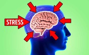 Stress có thể khiến não bạn bị teo nhỏ và đây là cách ngăn chặn Stress có thể khiến não bạn bị teo nhỏ và đây là cách ngăn chặn