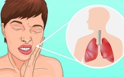 5 cơn đau "khó hiểu" khiến bạn dễ nhầm lẫn với đau răng nhưng có thể đó là dấu hiệu của những căn bệnh khó chữa 5 cơn đau "khó hiểu" khiến bạn dễ nhầm lẫn với đau răng nhưng có thể đó là dấu hiệu của những căn bệnh khó chữa