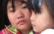 Bé gái 3 tuổi ở vùng cao đang chờ mổ lần cuối tái tạo hậu môn mà gia đình không còn tiền đi viện Bé gái 3 tuổi ở vùng cao đang chờ mổ lần cuối tái tạo hậu môn mà gia đình không còn tiền đi viện
