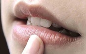 4 dấu hiệu bất thường trên miệng nhận biết có thể bạn đang mắc bệnh tim, cần chủ động đi khám sớm 4 dấu hiệu bất thường trên miệng nhận biết có thể bạn đang mắc bệnh tim, cần chủ động đi khám sớm