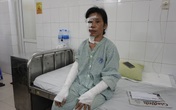 Qua cơn nguy kịch, người mẹ đơn thân nghèo bị bỏng nặng cảm ơn các nhà hảo tâm Qua cơn nguy kịch, người mẹ đơn thân nghèo bị bỏng nặng cảm ơn các nhà hảo tâm
