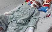 Xót xa mẹ đơn thân nghèo bị bỏng nặng xin về nhà vì không có tiền điều trị Xót xa mẹ đơn thân nghèo bị bỏng nặng xin về nhà vì không có tiền điều trị