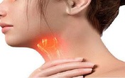 Tiêu Khiết Thanh - Giải pháp hỗ trợ an toàn cho người bị viêm thanh quản Tiêu Khiết Thanh - Giải pháp hỗ trợ an toàn cho người bị viêm thanh quản