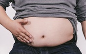 Bụng quá béo, người đàn ông bị thủng dạ dày, thối nội tạng mà không hề có cảm giác đau đớn Bụng quá béo, người đàn ông bị thủng dạ dày, thối nội tạng mà không hề có cảm giác đau đớn