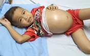 Xót xa cháu bé 5 tuổi bụng to như trống vì căn bệnh hiểm nghèo Xót xa cháu bé 5 tuổi bụng to như trống vì căn bệnh hiểm nghèo