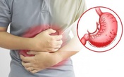 Viêm hang vị sung huyết, điều trị thế nào? Viêm hang vị sung huyết, điều trị thế nào?