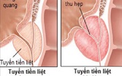 Những phương thuốc từ cỏ nhọ nồi Những phương thuốc từ cỏ nhọ nồi