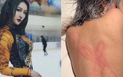 Bạn gái tố 'Ngũ A Ca' Khuất Sở Tiêu bạo dâm Bạn gái tố 'Ngũ A Ca' Khuất Sở Tiêu bạo dâm